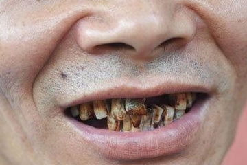 矿工告别难题破解！多重人生告别法大揭秘