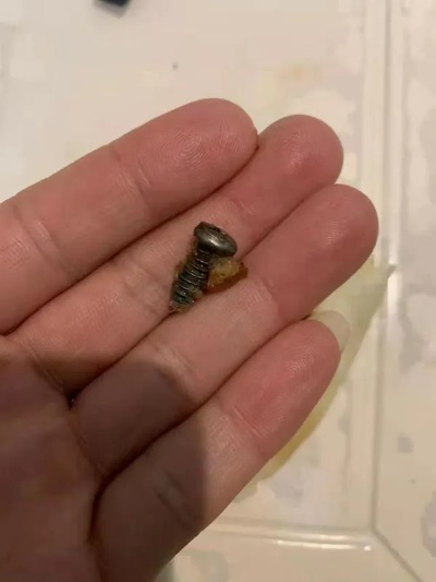 吃月饼咬到螺丝磕坏牙？2026最新维权指南+索赔实操全解析