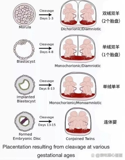 鲜为人知的生双胞胎类型全解析，适配热门备孕需求的科学实现指南