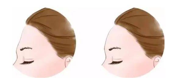 老滚5捏脸还在踩网红脸坑？3类核心脸型分类+热门需求全解法2026